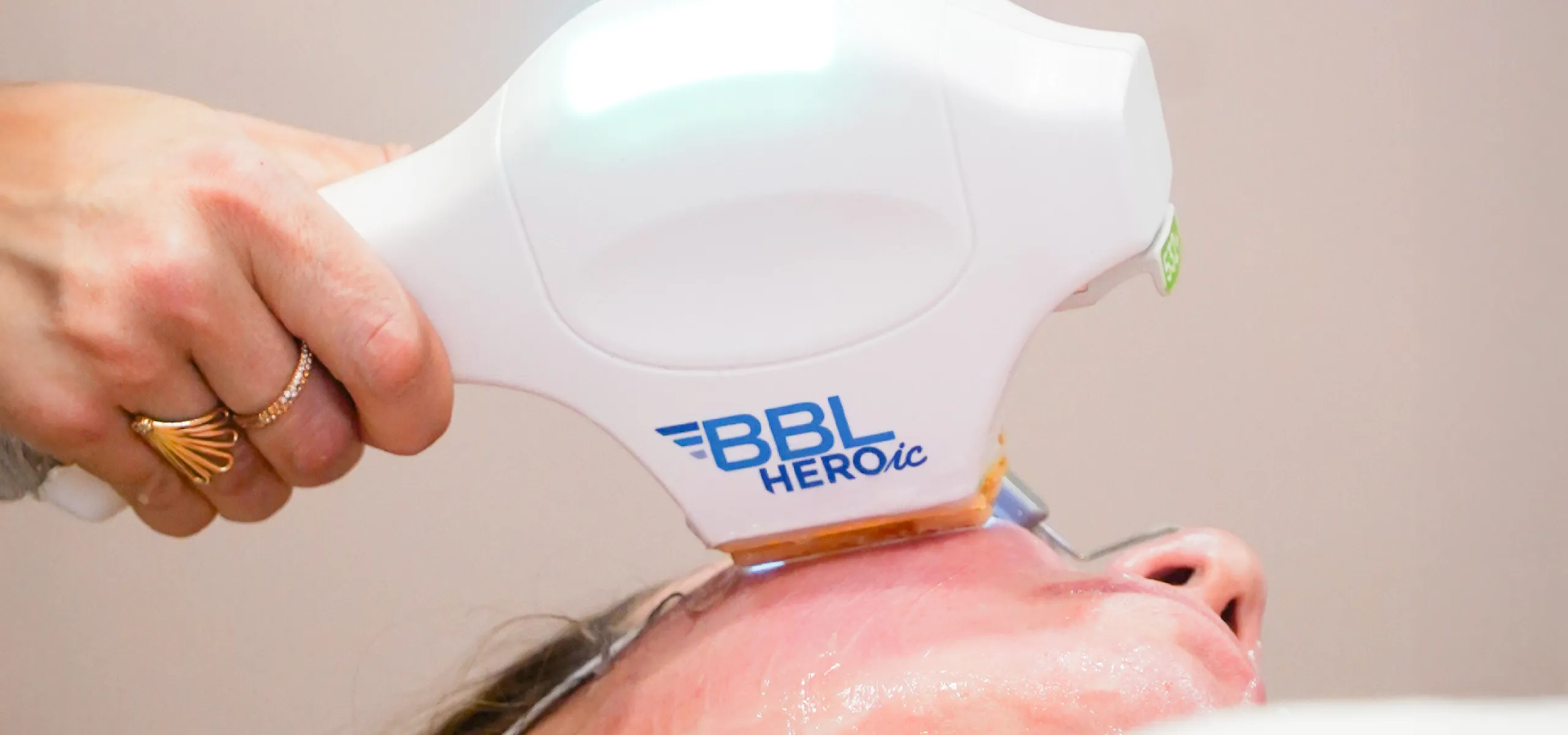 BBL HEROic + SkinTyte treatment detail