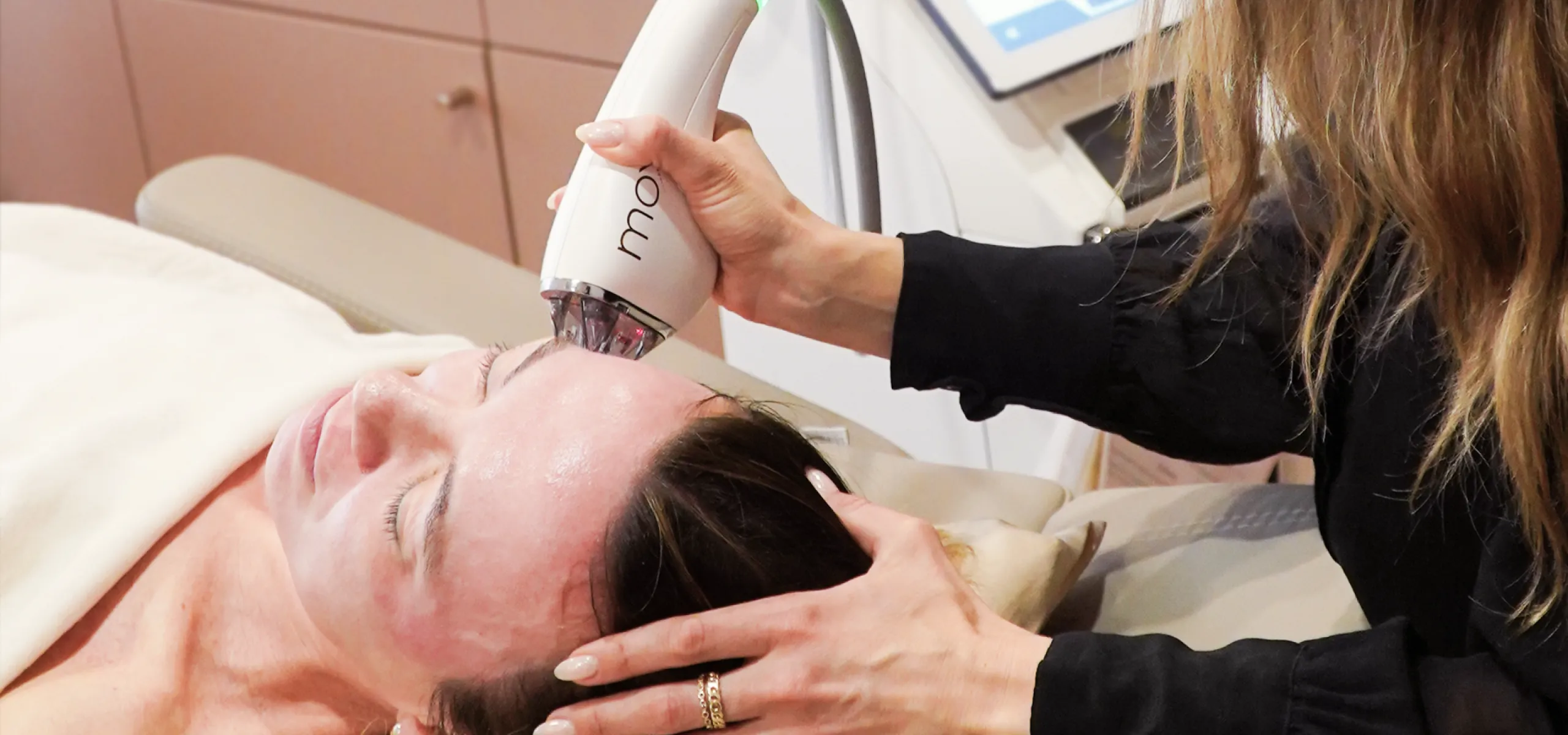 MOXI laser resurfacing at Zohar